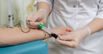 尿を見ればわかる…腎機能低下を疑う「危険サイン」