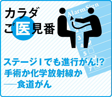 ステージＩでも進行がん!?手術か化学放射線か──食道がん