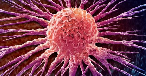 がんと遺伝はどう関係する？「がん家系」のアンジェリーナ・ジョリーが受けた予防的手術とは？