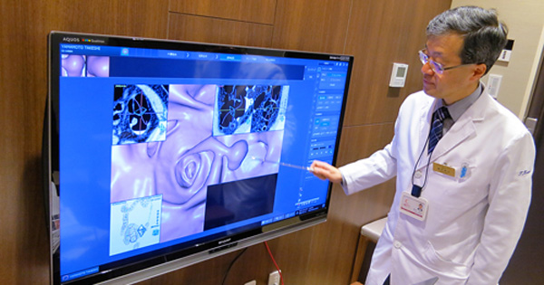本誌記者が実体験 全然痛くないバーチャル内視鏡の威力