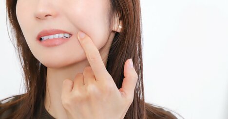 疲れ、ストレスも原因に!? イヤな口内炎対策に摂るべき食材とは？