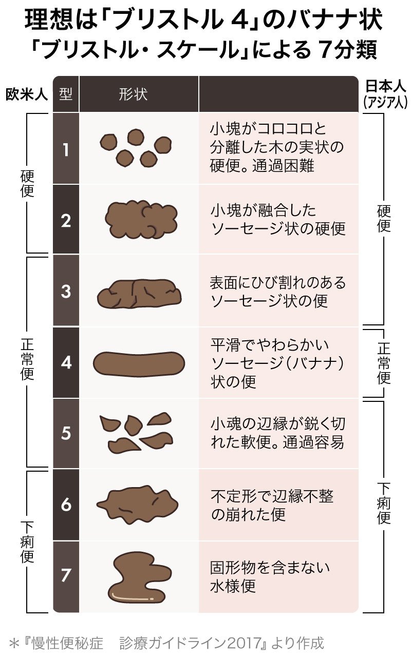 便秘治療の現場は新薬登場で 明治維新 理想の排便の夜明けを目指せ News Amp Analysis ダイヤモンド オンライン