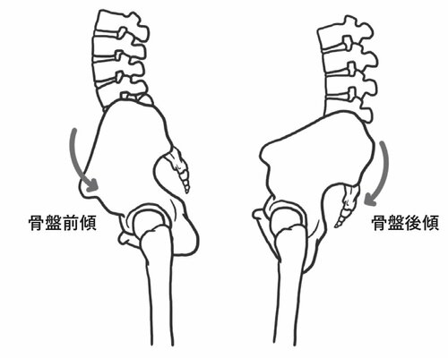 骨盤前傾,骨盤後傾