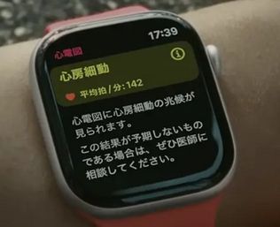 「怖い!心臓がすごい速さで動くよ…」Apple Watchで“死病”を予防、スマートウォッチが命の恩人になる日