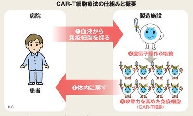 キムリアによる治療方法の概要