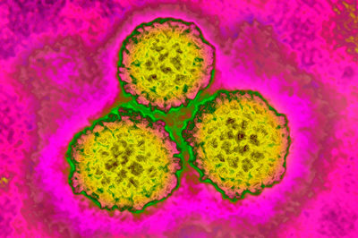 HPV（ヒトパピローマウイルス）の電子顕微鏡写真