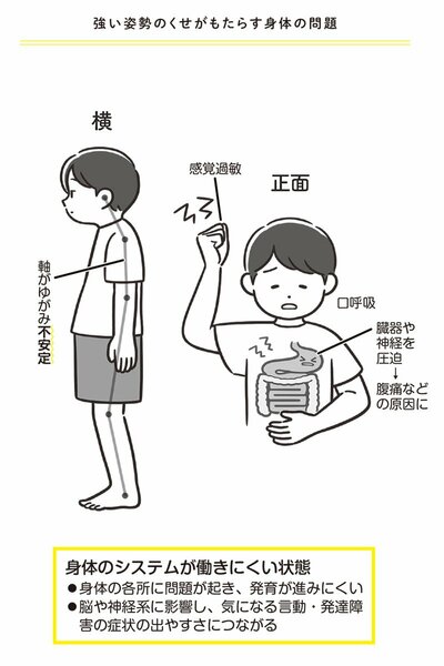 図・強い姿勢のくせがもたらす身体の問題