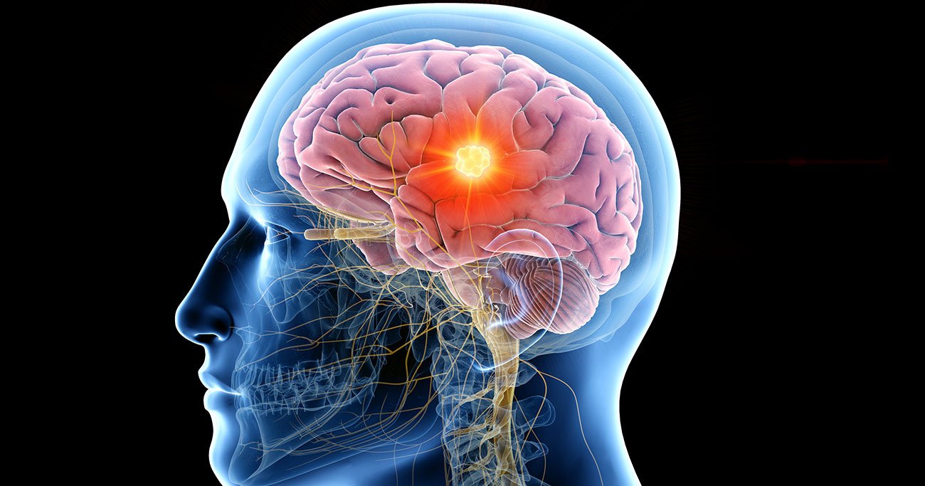 脳の働きを高める「グルコース」の効果的な補給方法