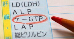 健康診断で「脂肪肝予備軍です」結果表の見方とγ-GTP値改善4つのコツ