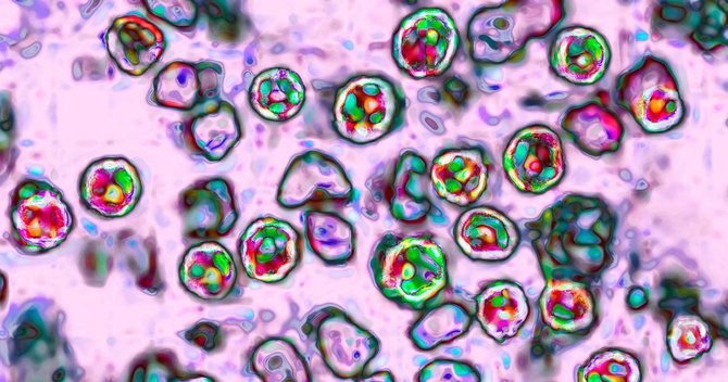 麻疹（はしか）ウイルス