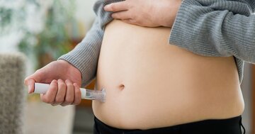 メガファーマが“爆買い”し始めた中国発「肥満症薬」の実力と勝算