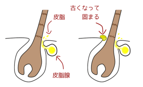 「この人、不潔かも…」男性会社員が真夏にやってはいけない「2つの髪型」【現役美容師が明かす】