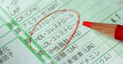 “善玉”コレステロールは「高ければ良い」というものではない