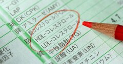 “善玉”コレステロールは「高ければ良い」というものではない