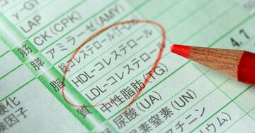 “善玉”コレステロールは「高ければ良い」というものではない