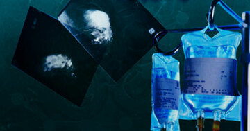 施設に馴染めない父親の介護で疲労困憊…不眠症になった50歳独身男性の孤独