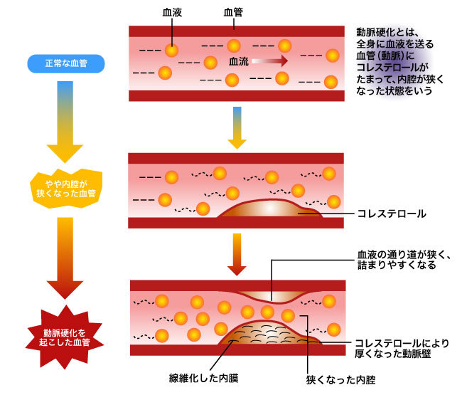 「コレステロールは身体に悪い」説はもう古い!