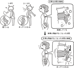 ねたんでいる相手を連想させる骨のゆがみ