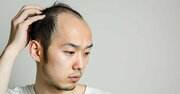 40歳で「異動させた方がいい」と思われるダメ会社員の特徴・ワースト3
