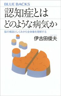 「これって認知症?」と思ったら…専門医が教える「心配な物忘れ」と「ただのうっかり」の見分け方