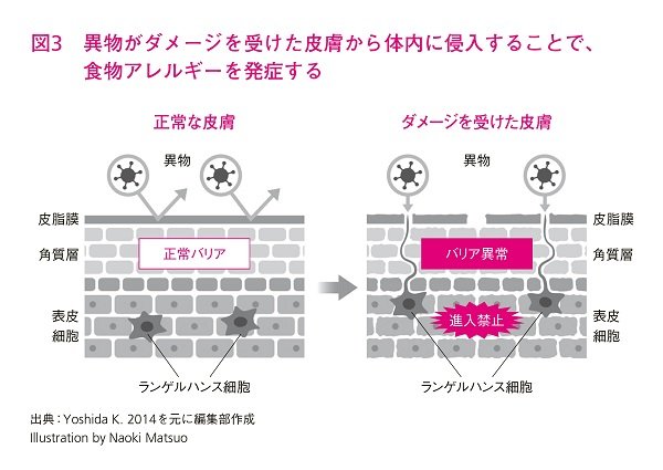 アレルギーになる原因は「皮膚」にある？最新研究が明かす真実