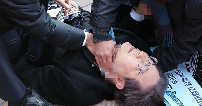 1月2日、釜山で首を刺された韓国の野党第一党「共に民主党」の党首、李在明氏李在明氏
