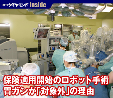 保険適用開始のロボット手術胃ガンが「対象外」の理由