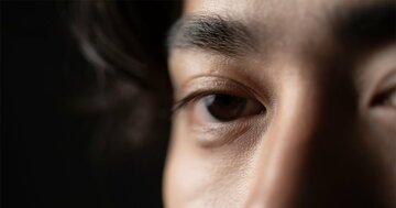 「なんにも見えない!」「野球できなかったら僕は…」脳腫瘍の手術を受けたプロ野球選手の絶望の叫び