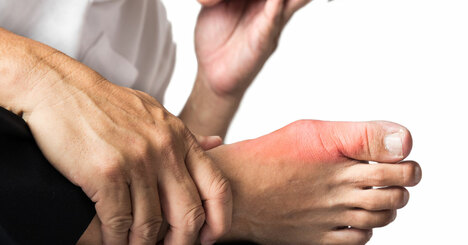 「痛風」の6つの原因、ビール＆魚卵より要注意の意外な食べ物は？