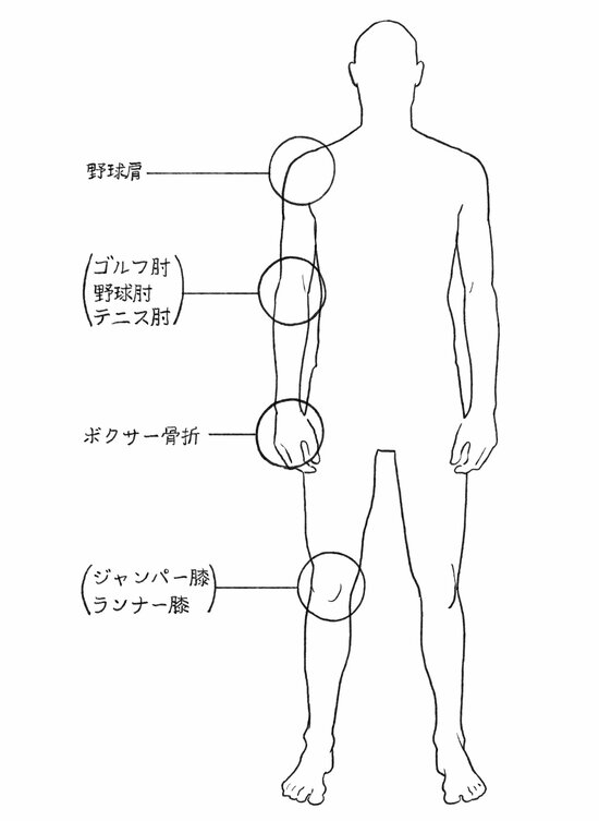 ゲームのやりすぎで親指が痛くなる?! 世界的権威の医学雑誌に掲載された「ニンテンディナイティス」とは？