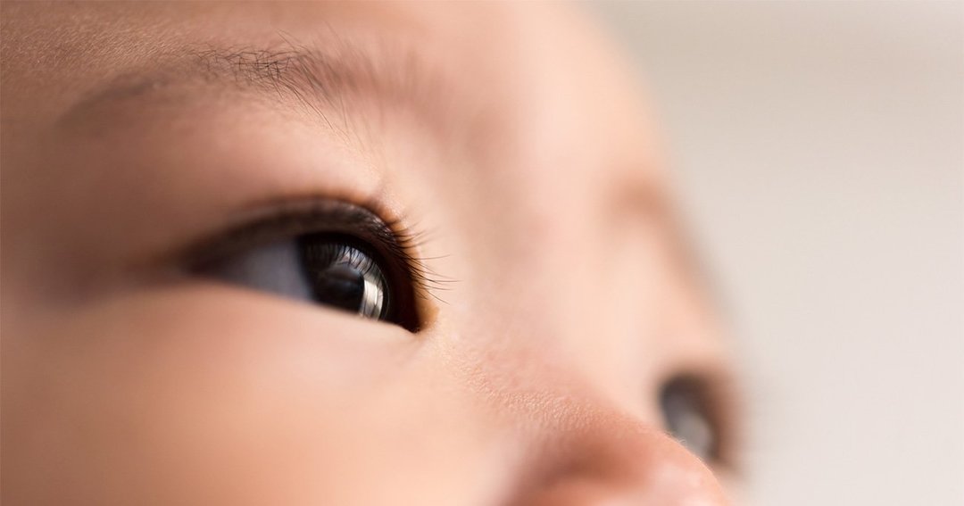 糖代謝異常や糖尿病を患う妊婦の子どもは、近視や遠視などの屈折異常が多い