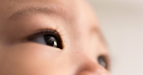 糖代謝異常や糖尿病を患う妊婦の子どもは、近視や遠視が多くなる研究報告