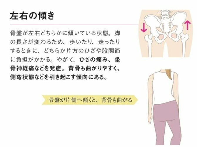 【整体プロが指南】腰痛が出やすい人の「2つの特徴」とは？ 早めに鍛えておきたい場所