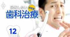 【無料公開】歯科医はマジメに治療するほど損!?根管治療、義歯に見る「保険診療制度の歪み」