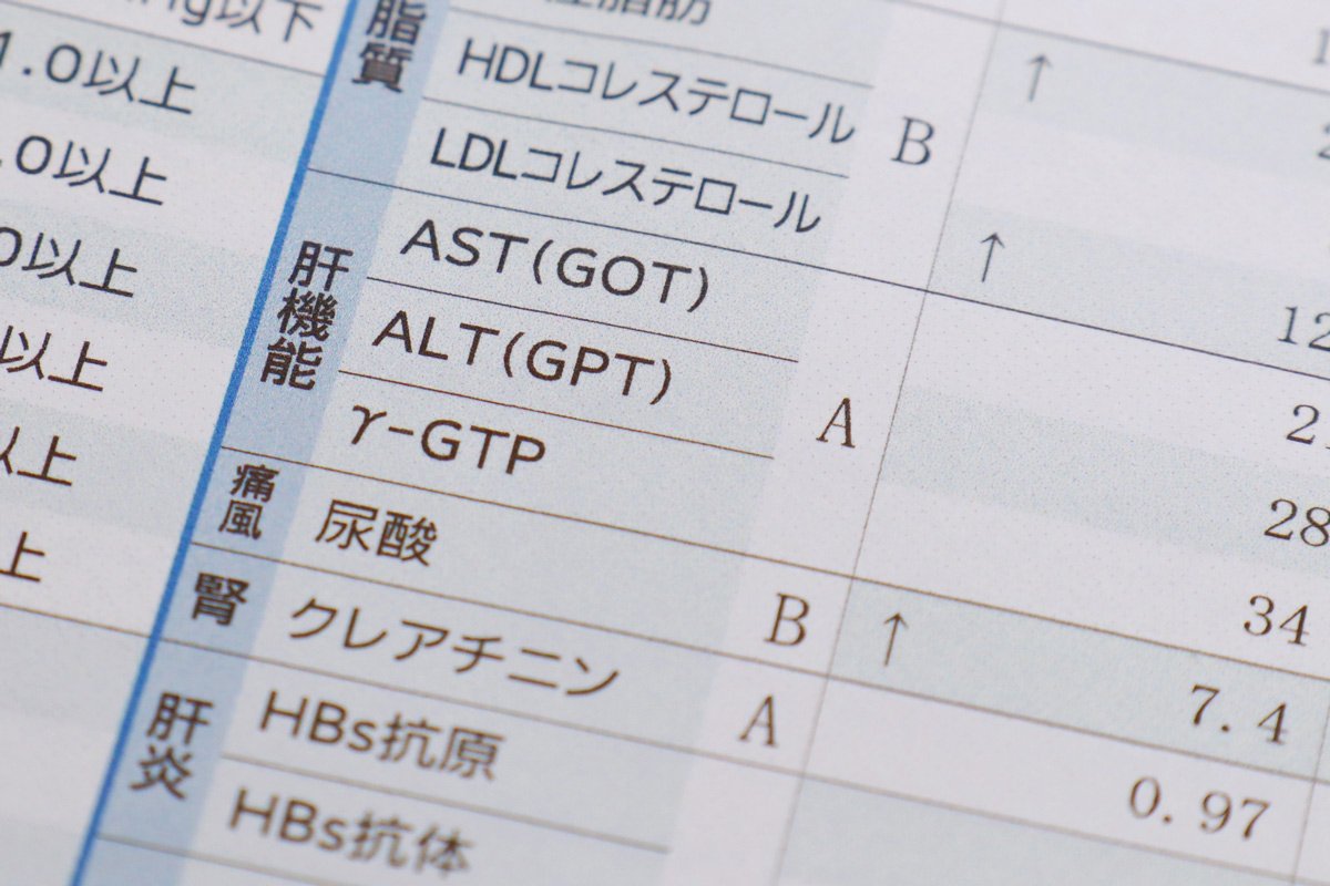 肝機能の推奨値を学会が初設定、「ALT(GPT)30超」は受診を