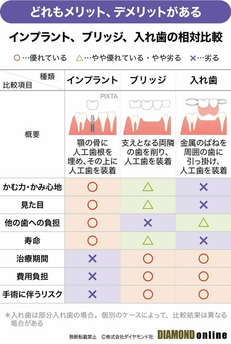 図表：インプラント、ブリッジ、入れ歯の相対比較