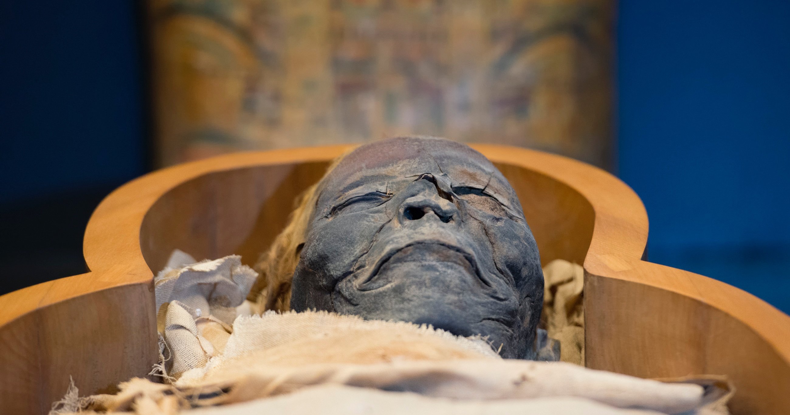 古代エジプト人のミイラからも発見！紀元前から人類を苦しめ続ける「病い」とは？