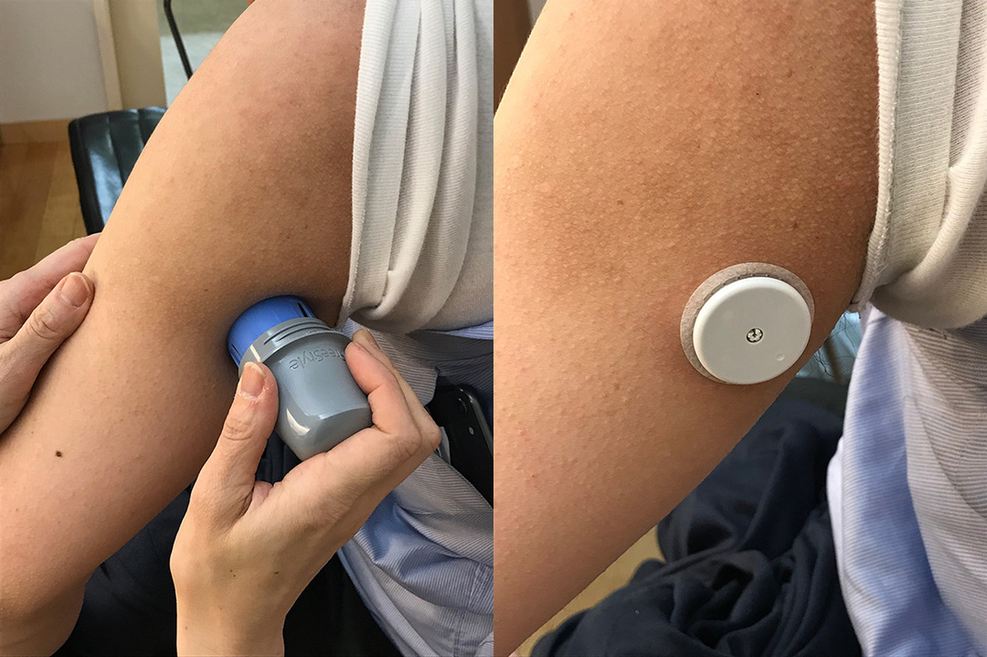血糖値測定器を付け、メタボに科学のメスを入れる【40男のダイエット(2)】