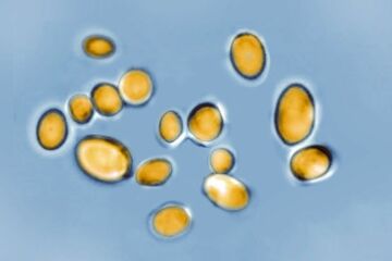 致死性の真菌感染、米で急拡大　衛生当局が警鐘