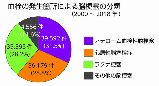 「言葉が出てこない」「片方の手が痺れる」…今すぐ病院へ！脳梗塞発症の危険性がある15の症状【専門医が警告】