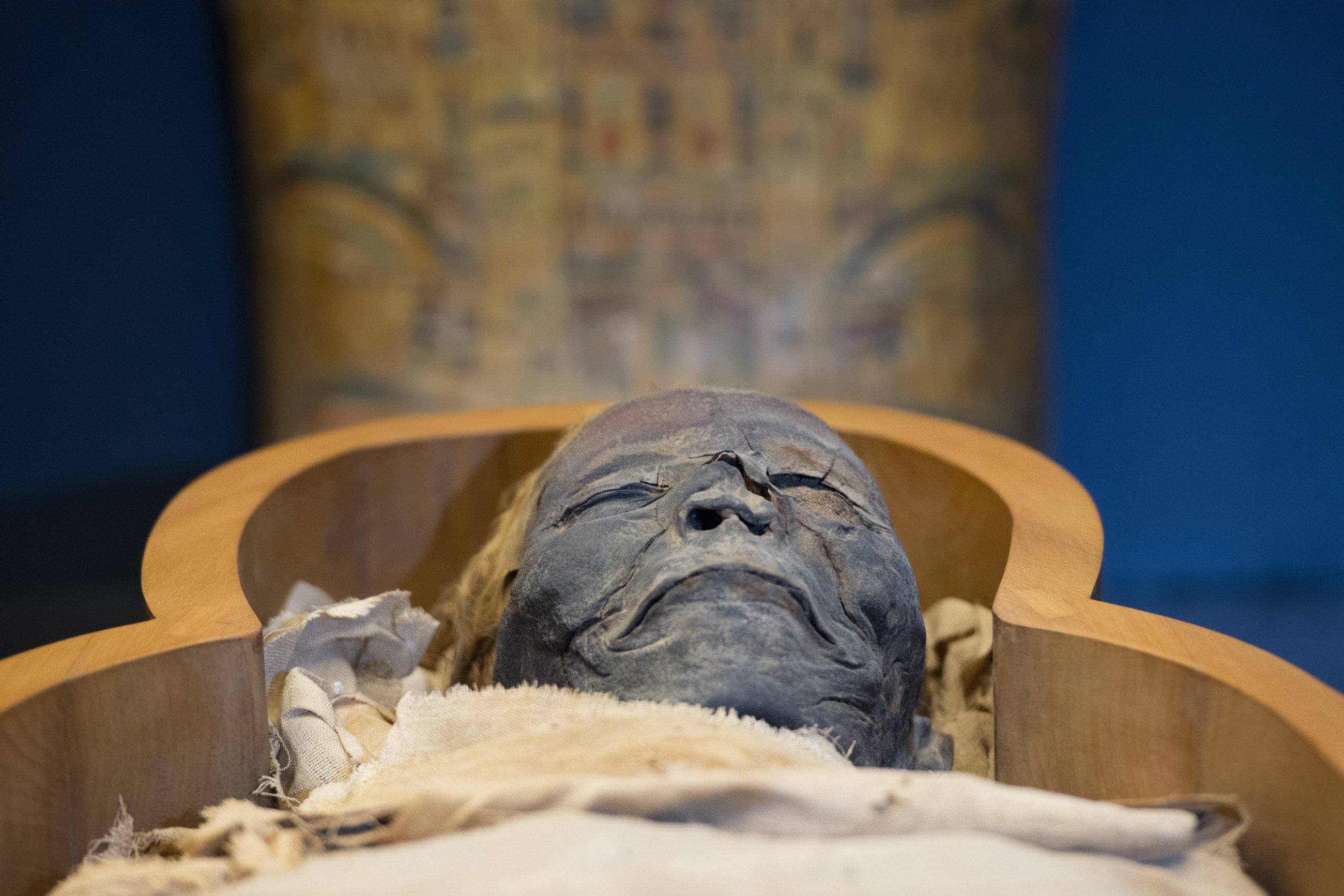古代エジプト人のミイラからも発見!紀元前から人類を苦しめ続ける「病い」とは?