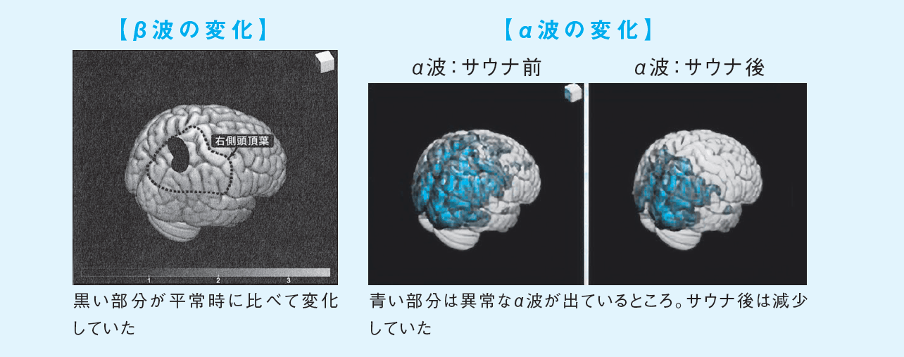 【サウナの科学】「ととのう」時、脳はどう変化している?