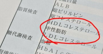 【医者が教える】「コレステロール」より注意すべき栄養とは?