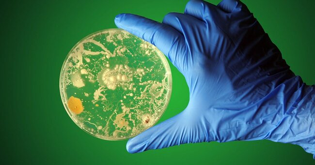 「命の危険がある真菌」感染者が全米で急増…除去困難、触れただけで感染の脅威
