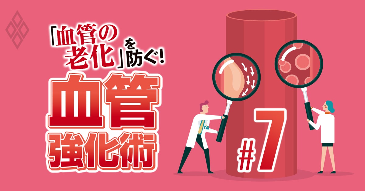 血管アンチエイジング5箇条の一つは「血管年齢を定期的に測ること」、その正しい測定方法とは？