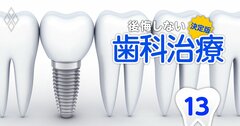 【無料公開】インプラントと歯科矯正「原価」の真相、高くて不透明な治療費の内訳大公開！