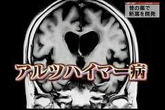 大ヒット商品が続々「特許切れ」へ。2010年以降、もう「新薬」は生まれない！?