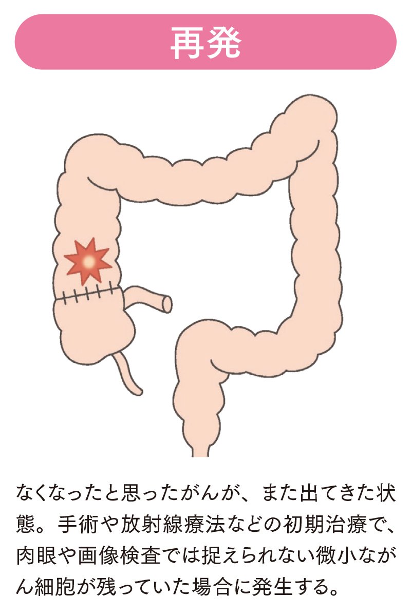 図表：再発　なくなったと思ったがんが、、あた出てきた状態