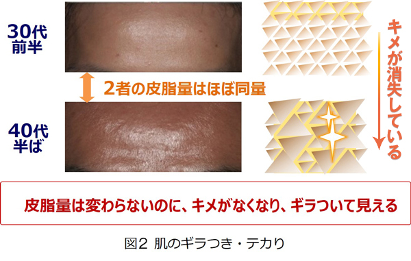 肌のギラつき、テカり