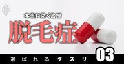 薄毛に効く治療薬ランキング下位の「非推奨薬」が、日本で一転「大プッシュ」される裏事情